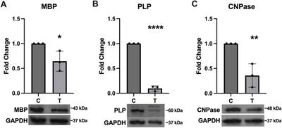 Endoplasmic reticulum stress alters myelin associated protein expression and extracellular vesicle composition in human oligodendrocytes